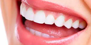 Naturally Straight Teeth