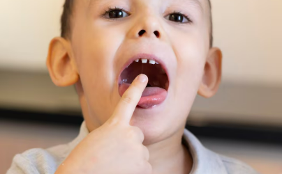 How Restricted Tongue Movement Affects Speech, Eating, and Dental Development