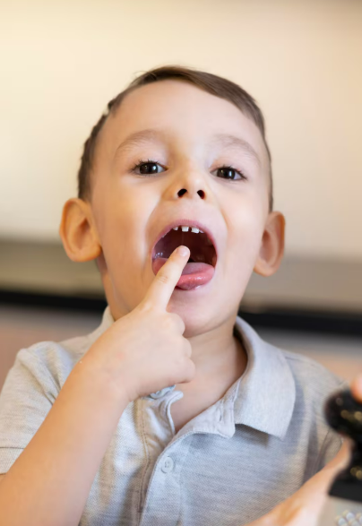 Milk Teeth Problems and Their Impact on Permanent Teeth