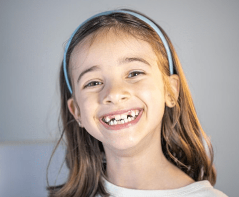 How to Prevent Crooked Teeth in Children Without Early Braces