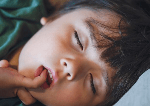 Open Mouth Sleeping in Children: Causes, Risks, and Solutions